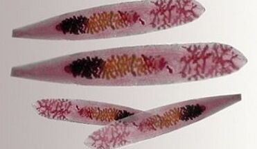 Opisthorchis parasiidid inimkehas