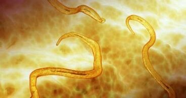 pinworm parasiidid inimkehas