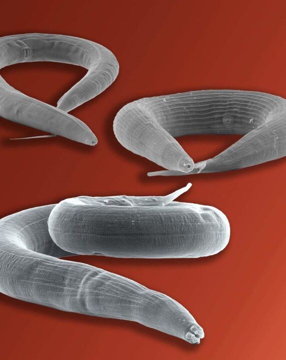 soolestikus elav pinworm-parasiit