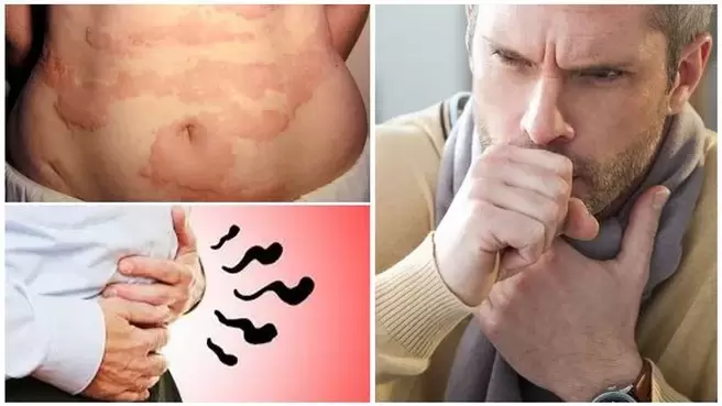 Allergia, köha ja puhitus on märgid usside tekitatud kehakahjustusest